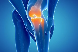 what is arthrosis
