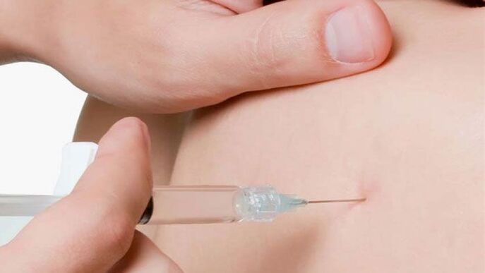 pharmacopuncture for breast osteochondrosis