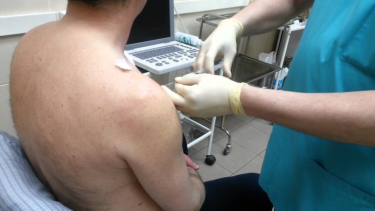 shoulder injection with osteoarthritis