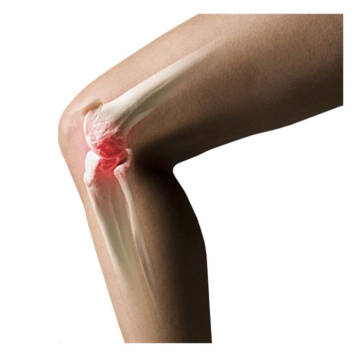 joint pain causes